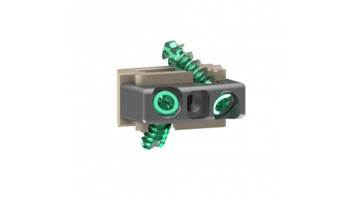 B-lock