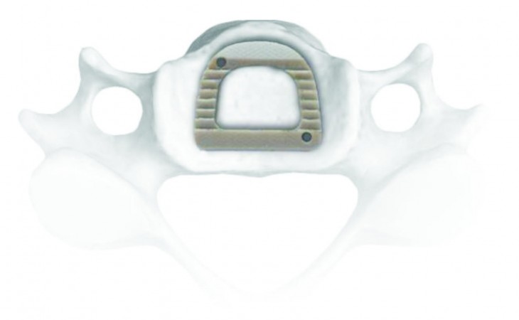 CAGE CERVICAL CDH