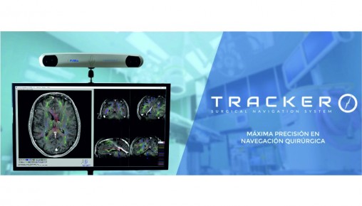 Neuronavegador Tracker
