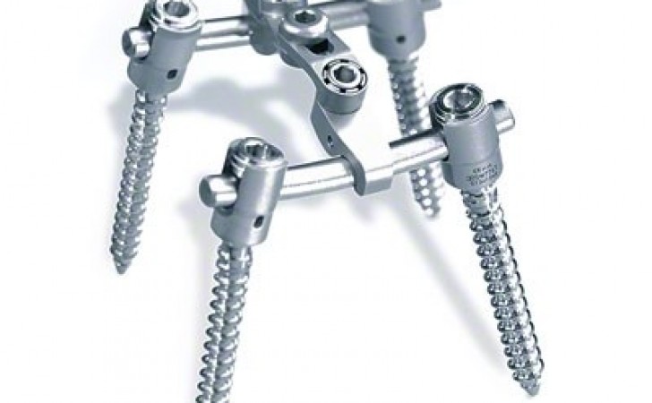 S4 Spinal System