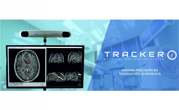 Neuronavegador Tracker